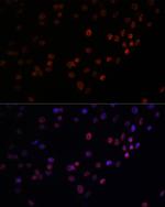 MATR3 Antibody in Immunocytochemistry (ICC/IF)
