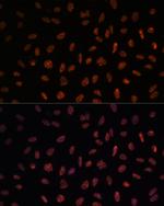 MATR3 Antibody in Immunocytochemistry (ICC/IF)