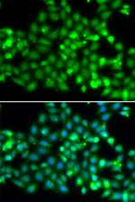 RNF36 Polyclonal Antibody