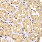 RNF36 Antibody in Immunohistochemistry (Paraffin) (IHC (P))
