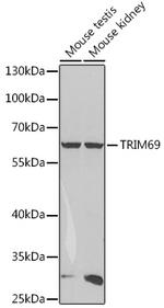 RNF36 Antibody in Western Blot (WB)