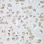 eIF1AX Antibody in Immunohistochemistry (Paraffin) (IHC (P))