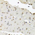 POLR2B Antibody in Immunohistochemistry (Paraffin) (IHC (P))