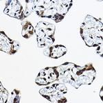 CIRBP Polyclonal Antibody