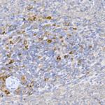 KMT2E Polyclonal Antibody