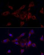 MMP2 Polyclonal Antibody