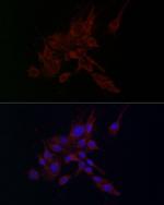 MMP2 Antibody in Immunocytochemistry (ICC/IF)