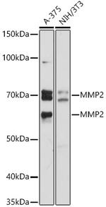 MMP2 Antibody in Western Blot (WB)