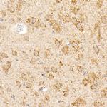 OGDH Antibody in Immunohistochemistry (Paraffin) (IHC (P))