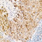OGDH Antibody in Immunohistochemistry (Paraffin) (IHC (P))