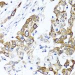 PPOX Polyclonal Antibody