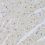 SNRPA Antibody in Immunohistochemistry (Paraffin) (IHC (P))