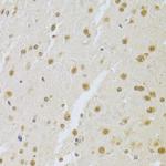 SNRPA Antibody in Immunohistochemistry (Paraffin) (IHC (P))