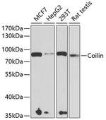 Coilin Polyclonal Antibody