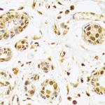 SEPHS1 Antibody in Immunohistochemistry (Paraffin) (IHC (P))