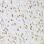 SEPHS1 Antibody in Immunohistochemistry (Paraffin) (IHC (P))