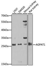 AGPAT1 Polyclonal Antibody