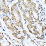 CMG2 Polyclonal Antibody