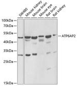 ATP6IP2 Polyclonal Antibody