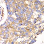Calpain S1 Polyclonal Antibody