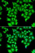 CPSF3L Polyclonal Antibody