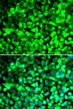 eIF5 Polyclonal Antibody