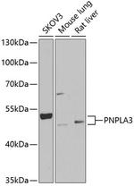 PNPLA3 Polyclonal Antibody
