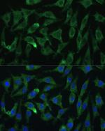 AGO2 Polyclonal Antibody