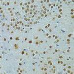 MUS81 Polyclonal Antibody