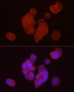 DGAT1 Antibody in Immunocytochemistry (ICC/IF)