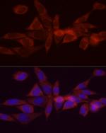 DGAT1 Polyclonal Antibody