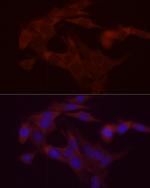 DGAT1 Antibody in Immunocytochemistry (ICC/IF)