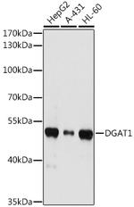 DGAT1 Antibody in Western Blot (WB)