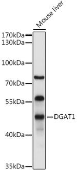 DGAT1 Antibody in Western Blot (WB)