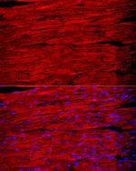 Myosin heavy chain 1 Polyclonal Antibody