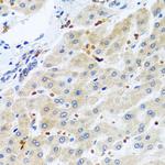 RGS5 Polyclonal Antibody