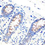 SCO2 Polyclonal Antibody