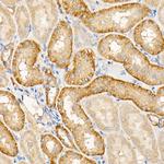 TES Antibody in Immunohistochemistry (Paraffin) (IHC (P))