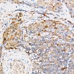 TES Polyclonal Antibody