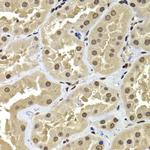 BAF53B Antibody in Immunohistochemistry (Paraffin) (IHC (P))