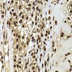 BAF53B Antibody in Immunohistochemistry (Paraffin) (IHC (P))