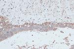 LC3B Polyclonal Antibody