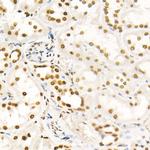 H4K8ac Antibody in Immunohistochemistry (Paraffin) (IHC (P))