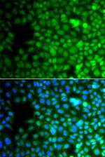 ZNF195 Polyclonal Antibody