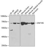 ZNF195 Antibody in Western Blot (WB)