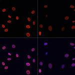 H4K91ac Polyclonal Antibody