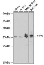Cathepsin V Polyclonal Antibody