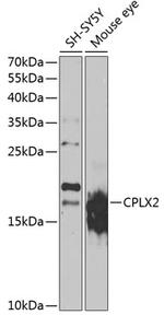 CPLX2 Polyclonal Antibody