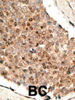 BMP-10 Polyclonal Antibody