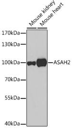 ASAH2 Polyclonal Antibody